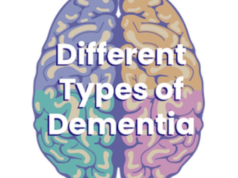 7 Types of Dementia